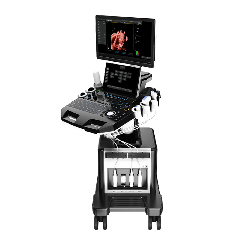 MN-Ultra7A Double Screen Ultrasound Machine Medical Mobile Ultrasound Instruments  Medical Mobile Ultrasound Instruments