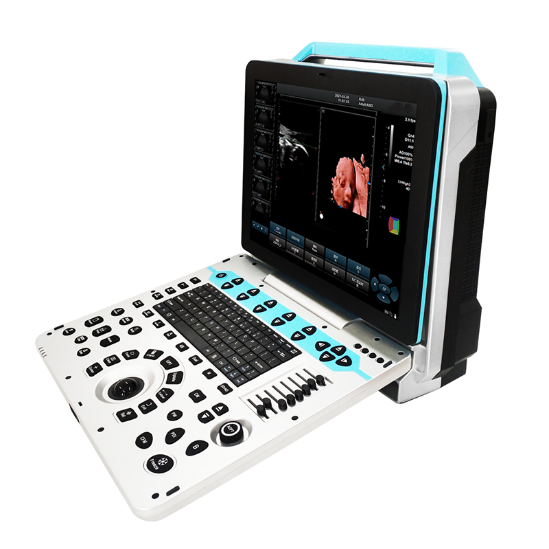 MN-Ultra5  3D 4D 5D Medical Echo Portable Ultrasound Scan Machine Portable Color Doppler