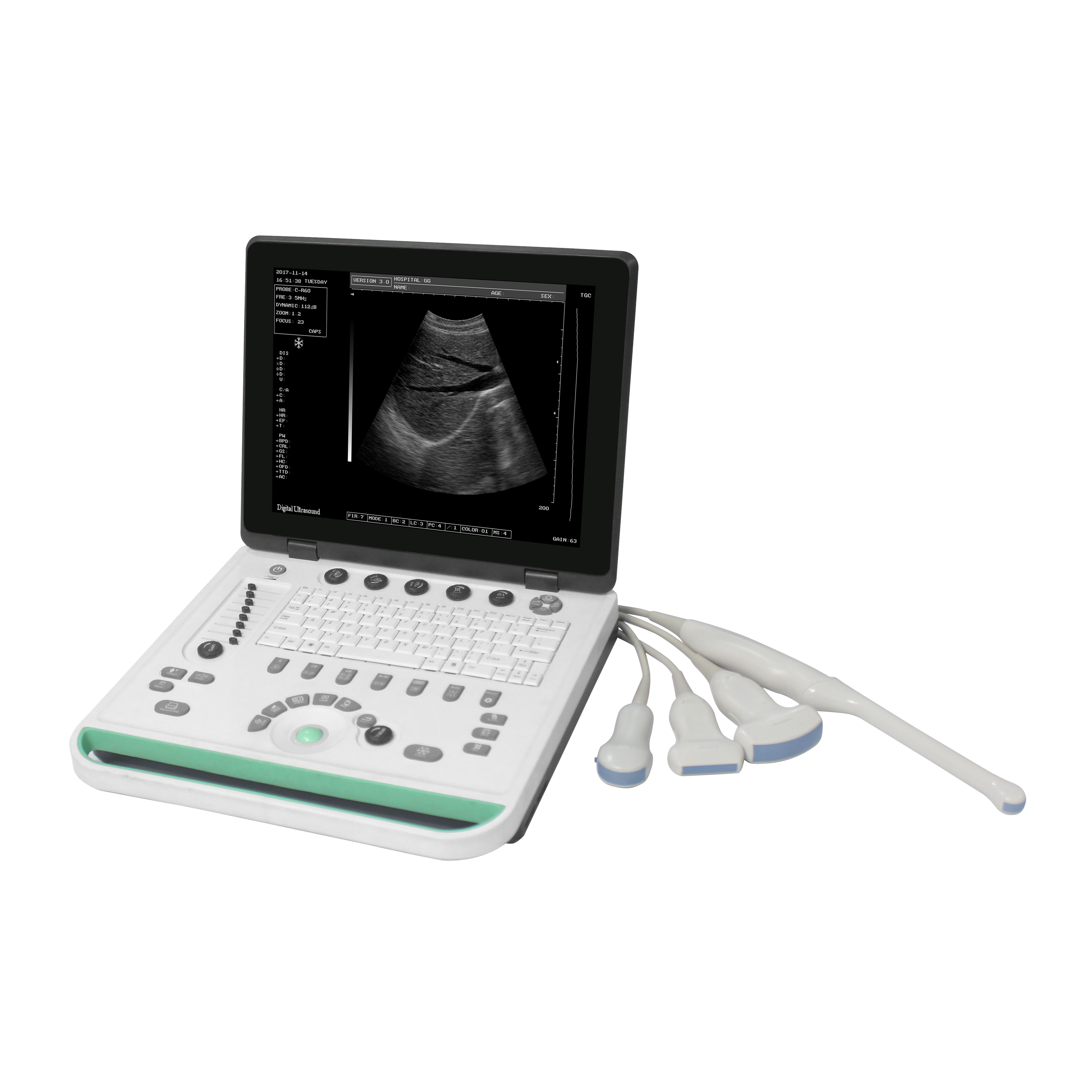maMN-Ultra1 Basic B Ultrasound Full Digital Ultrasound  Instrument With  Pseudo-color Function