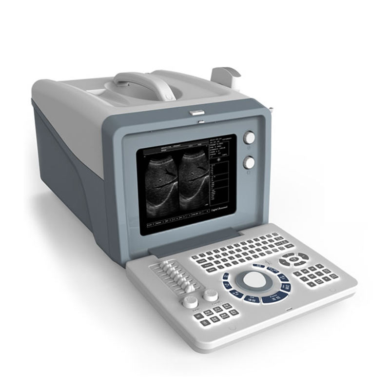 MN-S218 Clinic medical portable black and white ultrasound machine for patient diagnosis use
