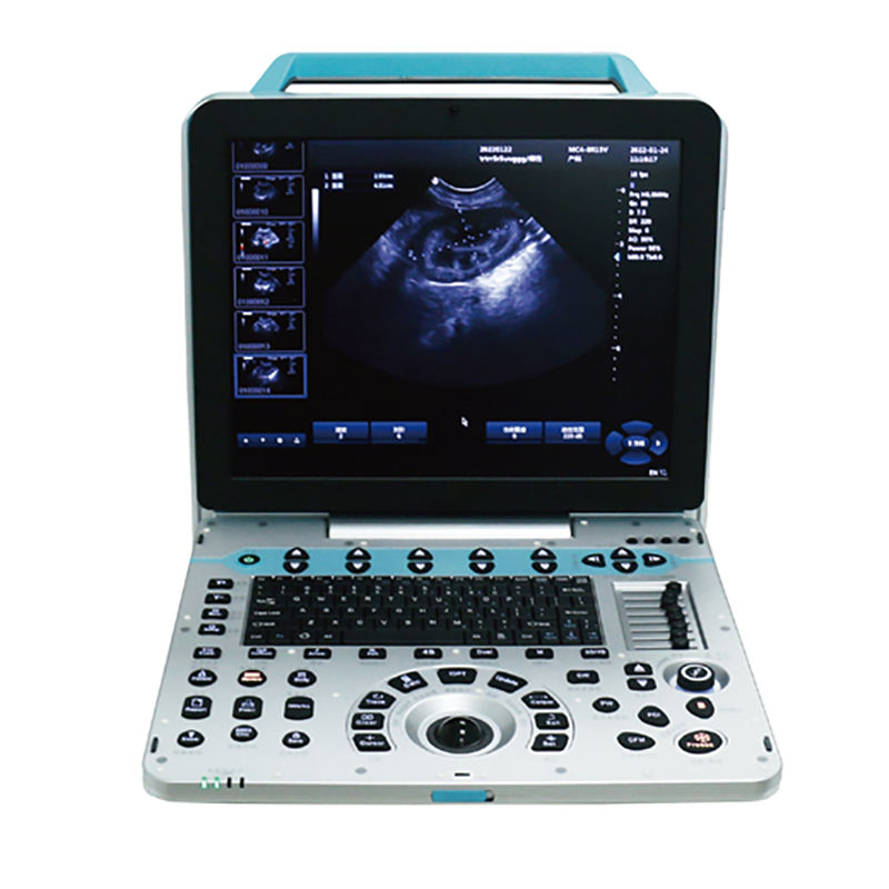 MN-Ultra5  3D 4D 5D Medical Echo Portable Ultrasound Scan Machine Portable Color Doppler