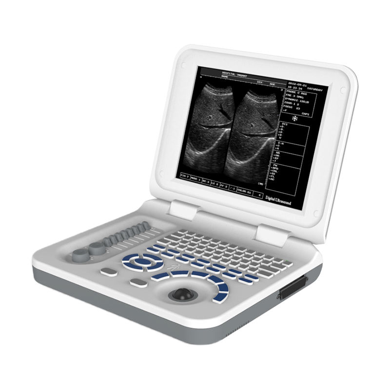 MN-S30  Medical Equipment B Ultrasound Scanner Laptop Ultrasound Machine For Hospital Clinic