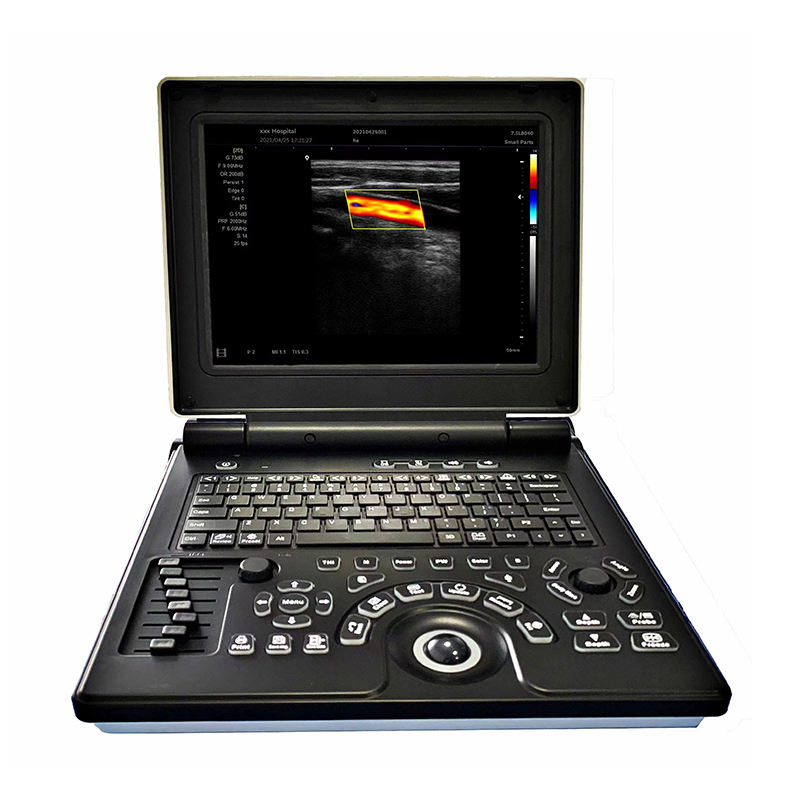 MN-E20 Hospital Medical 3D Laptop Ultrasound Machine Full Digital Ultrasound Scanner with Multi-language