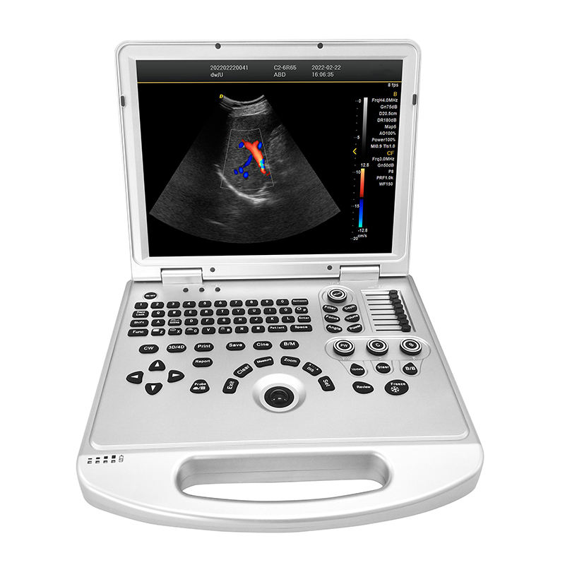 MN-UltraL3 Ultrasound portable color doppler medical ultrasound instruments  3d and 4d ultrasound