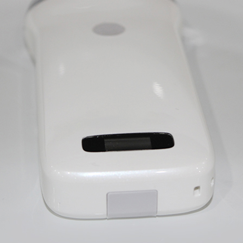 MN-Ultra3L Portable Wireless Ultrasound Medical Ultrasound Scanner