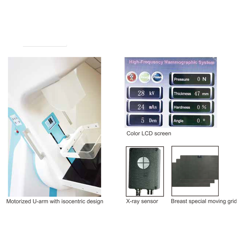 MN-MA001 High Frequency Mammography System Mammo X-Ray Machine the Most Accurate and Earlist Way to Check the Mammo Diseases