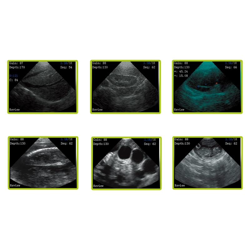 MN-Ultra4 Hospital Equipment Medical Wireless Ultrasound Scanner with Convex Probe