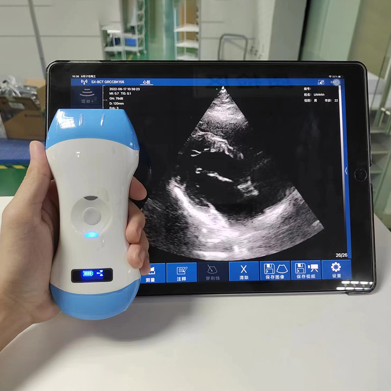 MN-Ultra5CPL 2 in 1 Convex and Linear Probe Medical Ultrasound Machine